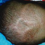 Les fontanelles de bébé